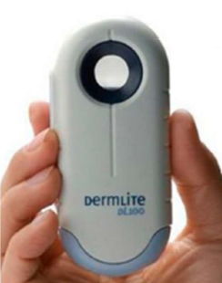 Dermatoscopio DermLite para diagnóstico de verrugas